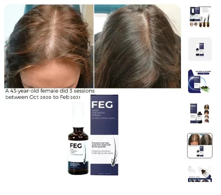 🔥Natural Hair Growth Spray